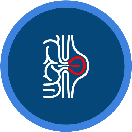 hernia-umbilical